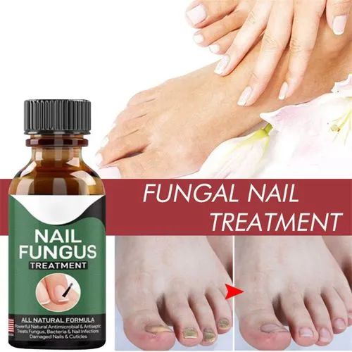 Fast Nail Fungus Treatment & Repair Serum | Anti-Fungal Nail Care Gel