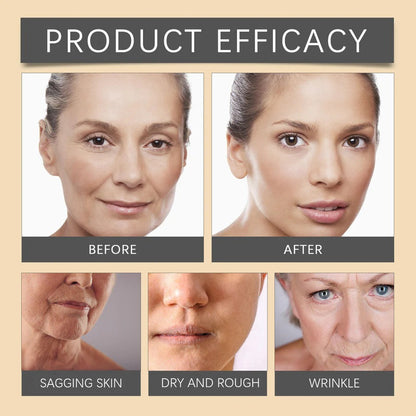 Botox Bee Venom Wrinkle Removal Cream