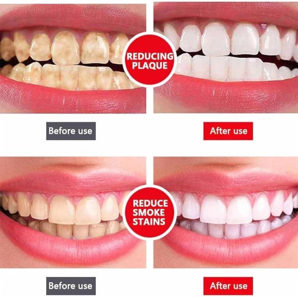 Yayashi SP-4 Whitening Toothpaste