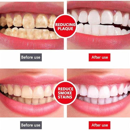 Yayashi SP-4 Whitening Toothpaste